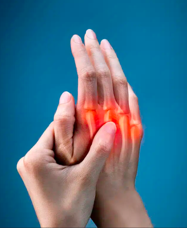 E-bog om finger- og håndsmerter